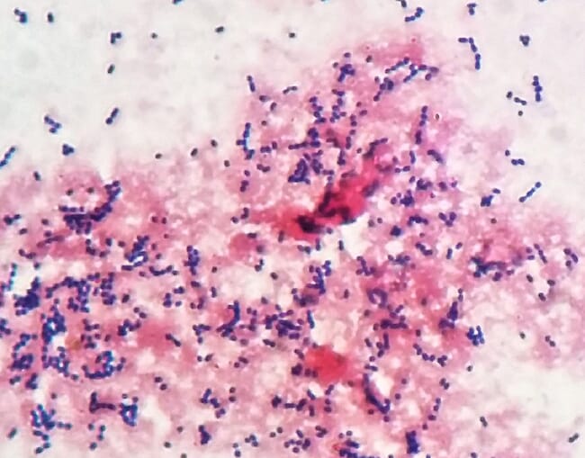 Strep stain